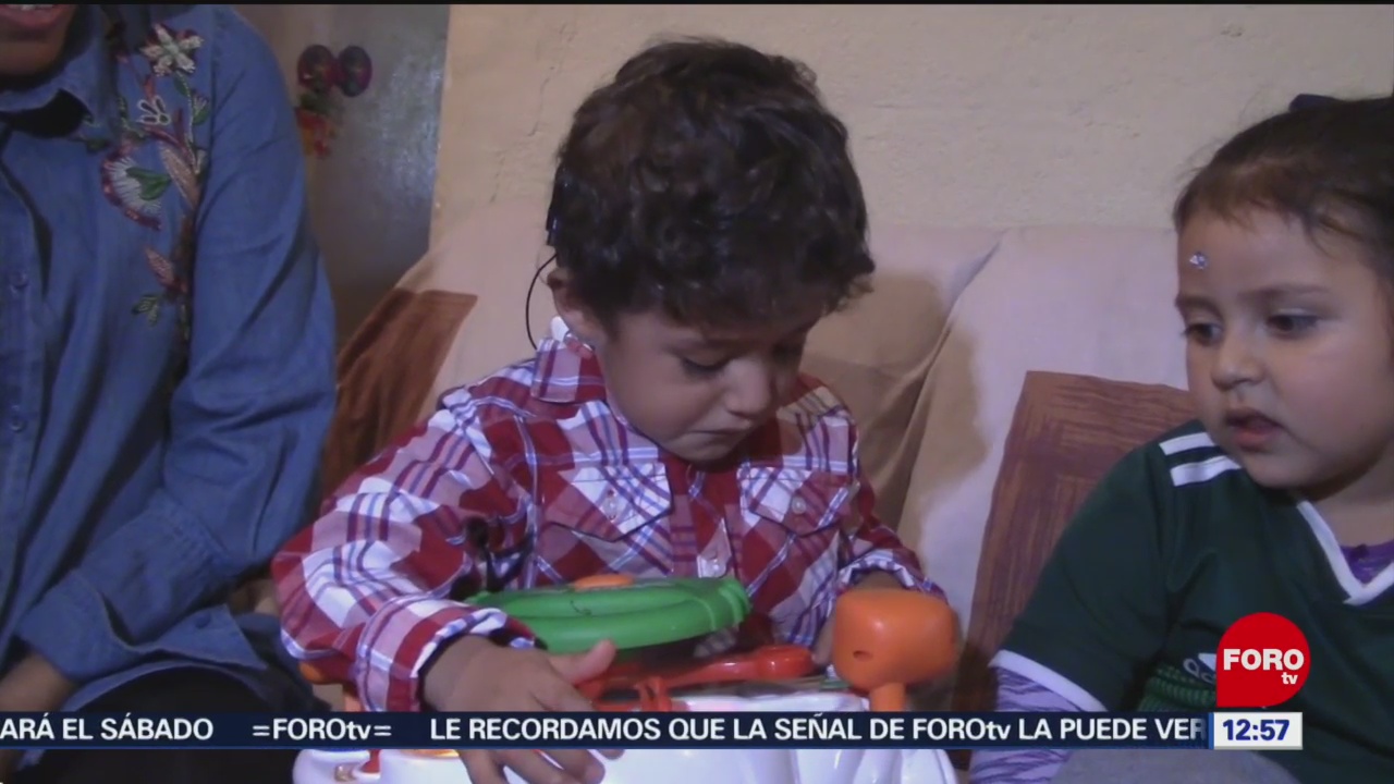 Foto: Niño escucha por primera vez, gracias a implante coclear