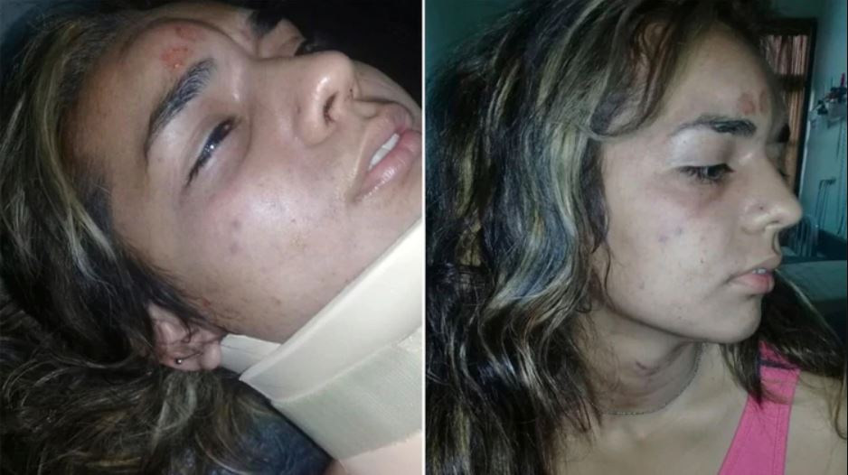 Candela Castro tomó fotografías después del tratamiento de sus heridas tras el ataque (Facebook)
