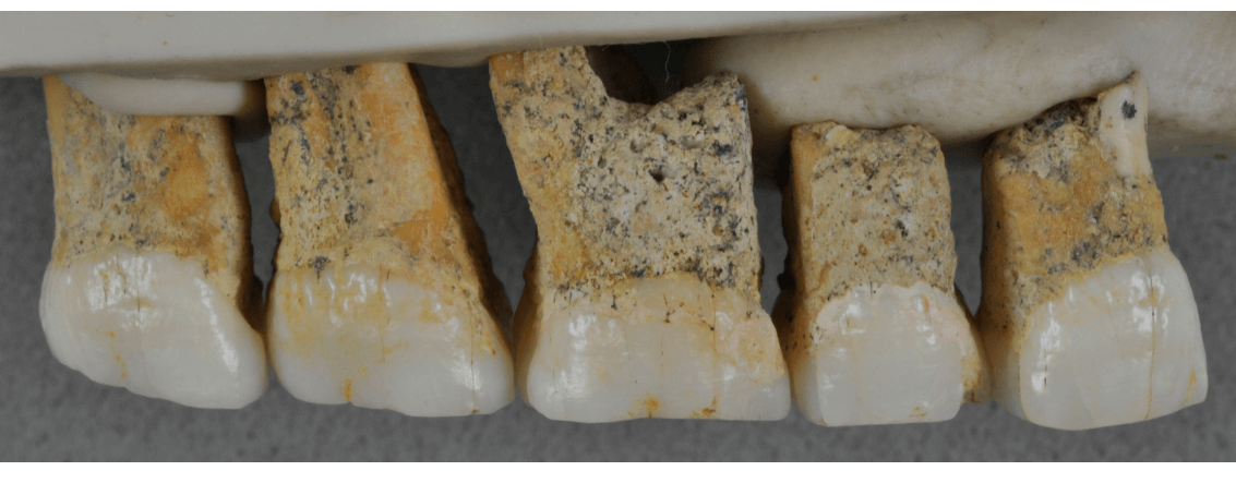 Foto: Los dientes del Homo Luzonensis, hallado en Filipinas, 10 de abril de 2019
