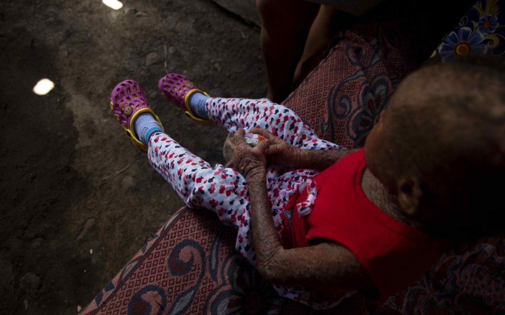 Niña ‘piel de pescado’ de Nicaragua recibe un milagro de un ángel