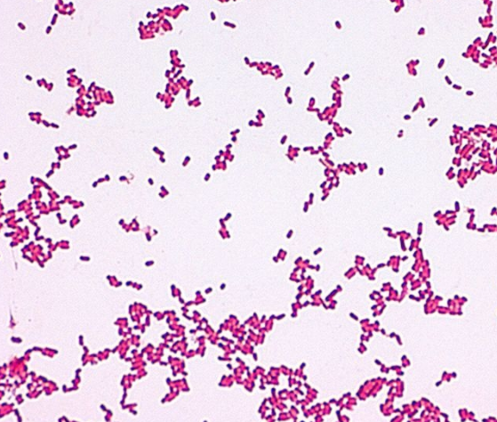 IMAGEN Jalisco registra un brote infeccioso por la bacteria Leclercia adecarboxylata en 9 hospitales (Microbe Canvas)