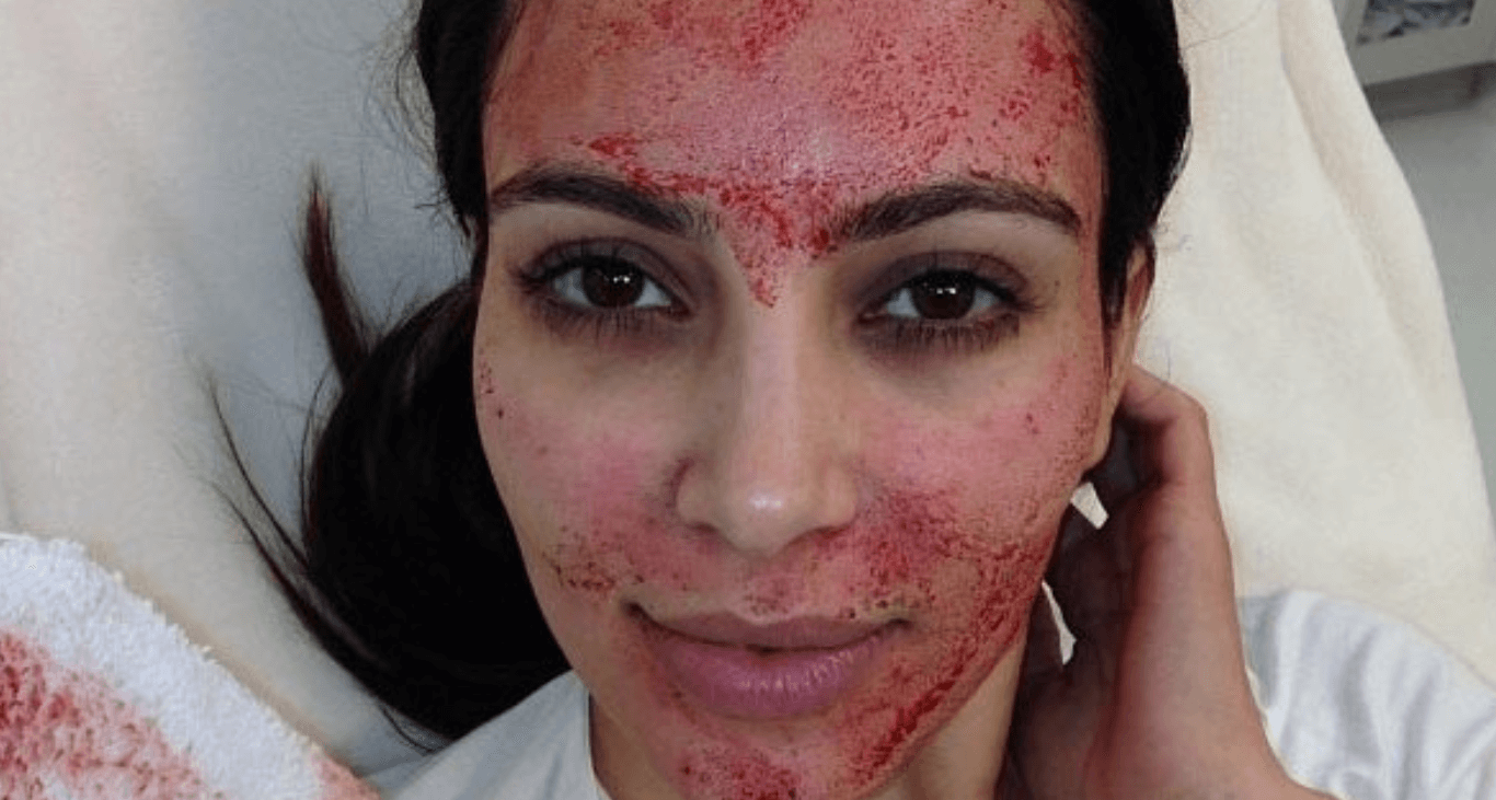 FOTO Kim Kardashian mostró cuando se hizo un facial vampiro (Allure)