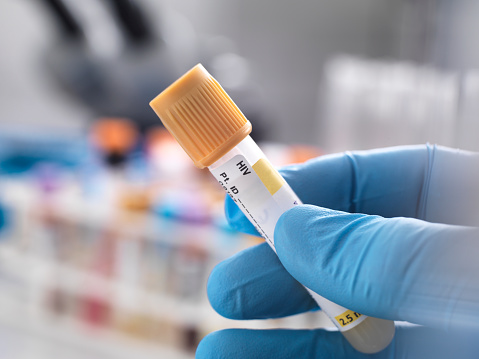 UNAM patenta fórmula que protege hígado de pacientes con VIH