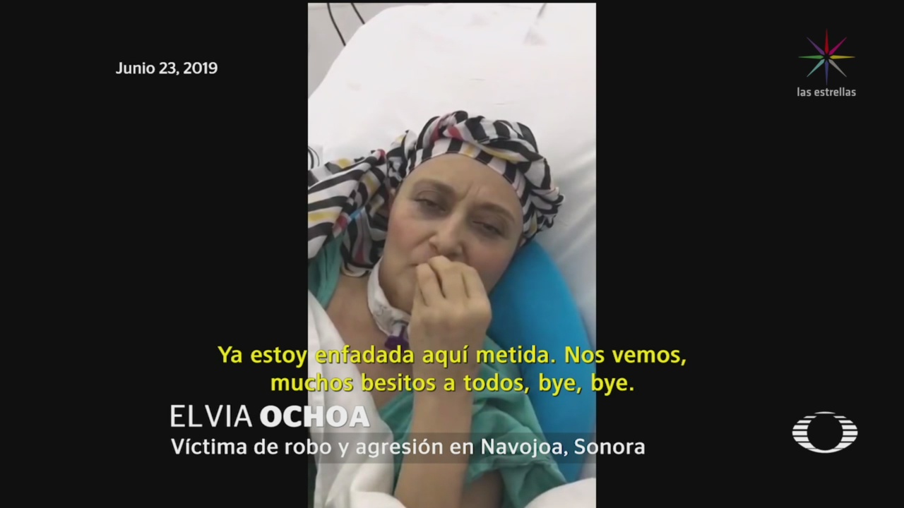 Foto: Despierta Mujer Recibió Batazo Navojoa 24 Junio 2019