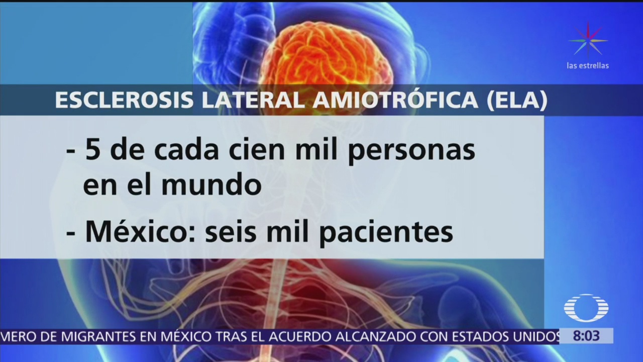 Esclerosis Lateral Amiotrófica afecta a 5 de cada 100 mil personas