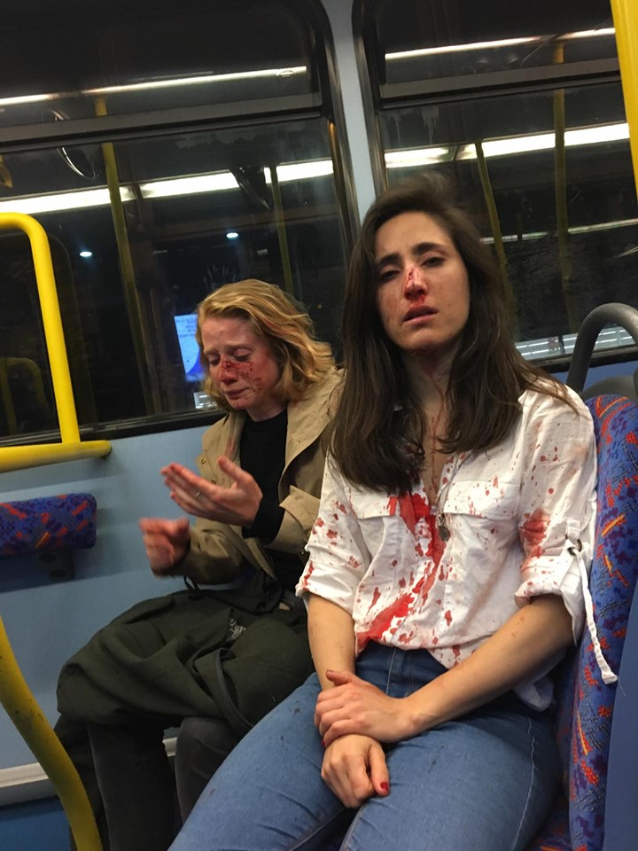 Foto Pareja de lesbianas sufre brutal ataque homófobo en Londres 7 junio 2019