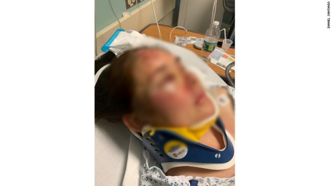 FOTO Madre fue brutalmente golpeada por defender a su hijo de bullying racial 28 junio 2019