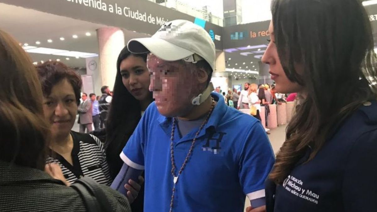 Sobreviviente de Tlahuelilpan regresa a México tras 6 meses de tratamiento en EU