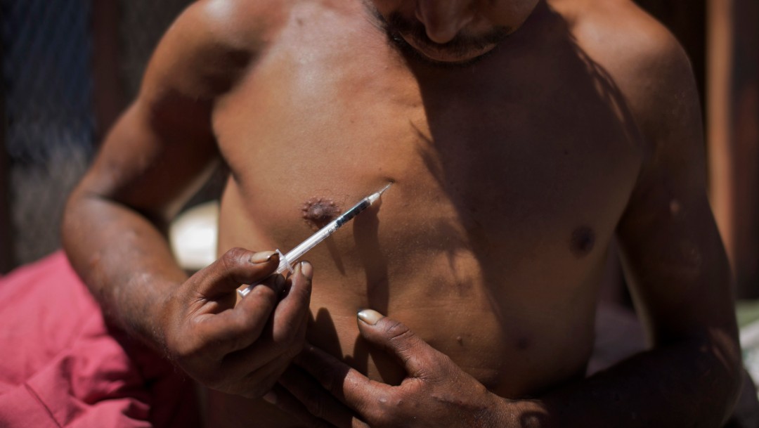 Foto: Hombre inyectándose heroína en Tijuana, 25 de agosto de 2009, México