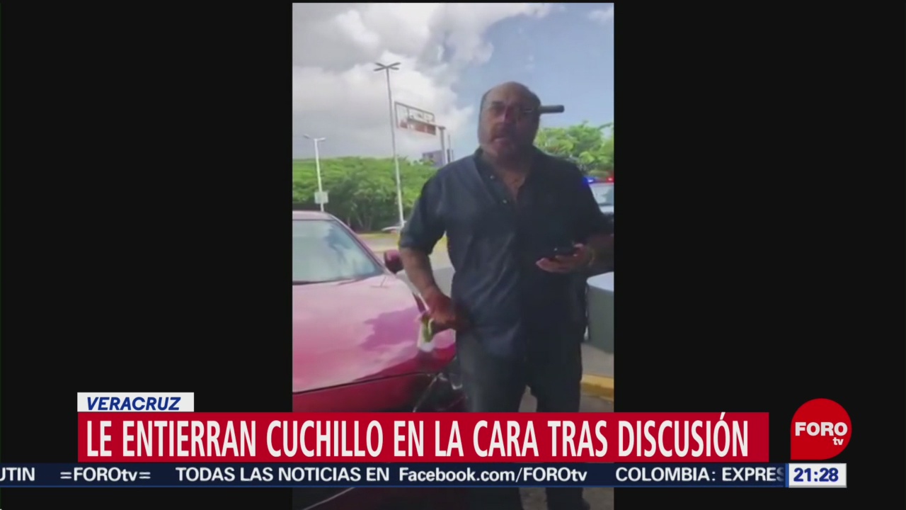 Foto: Video Entierran Cuchillo Cara Lugar Estacionamiento Veracruz 10 Julio 2019