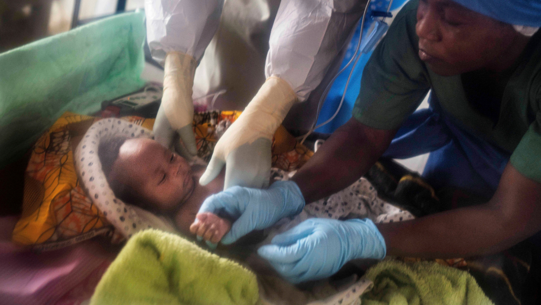 FOTO Bebé enfermo de ébola en el Congo (AP)