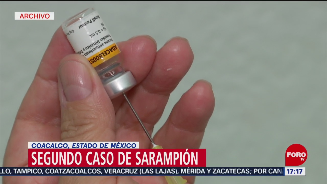 Foto: Secretaría Salud Edomex Confirma Segundo Caso Sarampión
