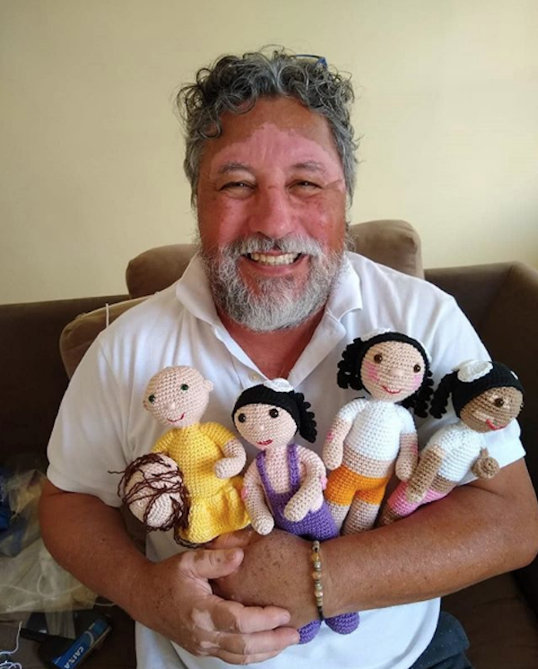 Foto Abuelo crea muñecas con vitiligo para su nieta 10 septiembre 2019