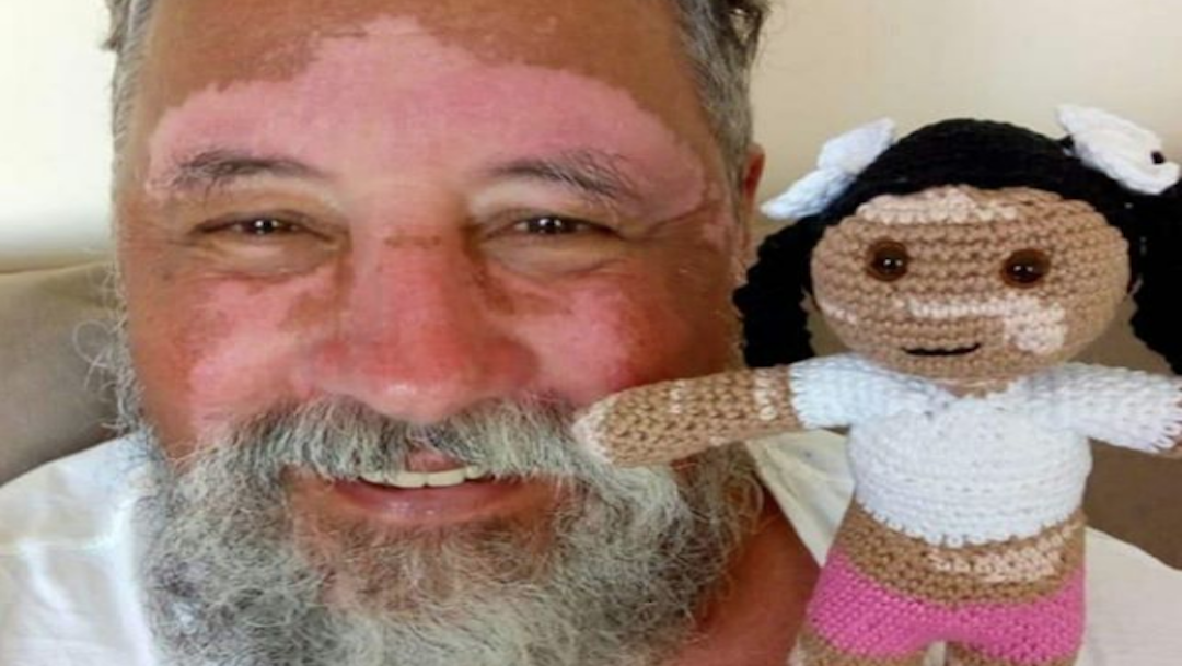 Foto Abuelo crea muñecas con vitiligo para su nieta 10 septiembre 2019
