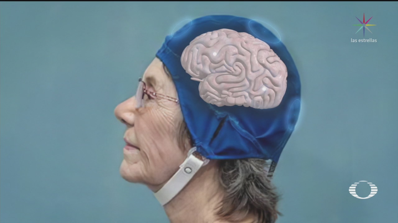 Crean casco que revierte deterioro cognitivo provocado por Alzheimer