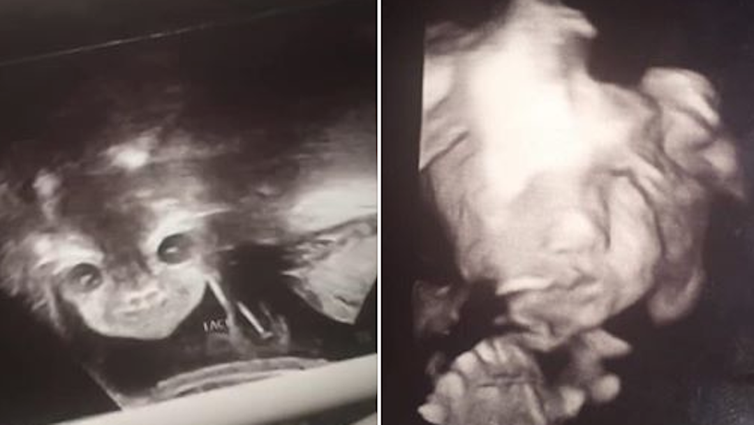 Foto Mujer se hace una ecografía; dice que su bebé parece diablo 12 septiembre 2019