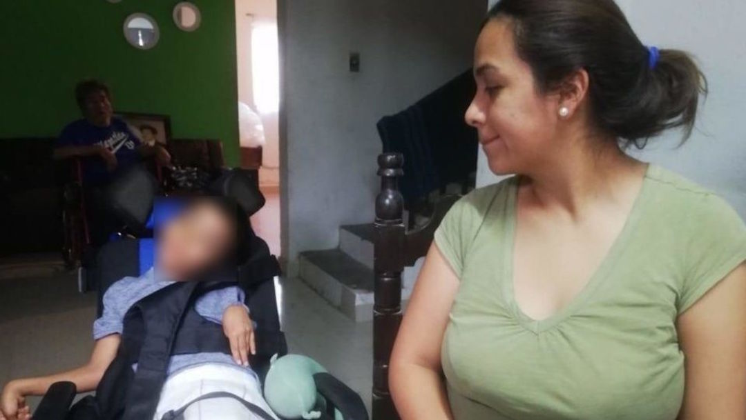 Foto Niño muerde una pila y termina con parálisis cerebral 26 septiembre 2019
