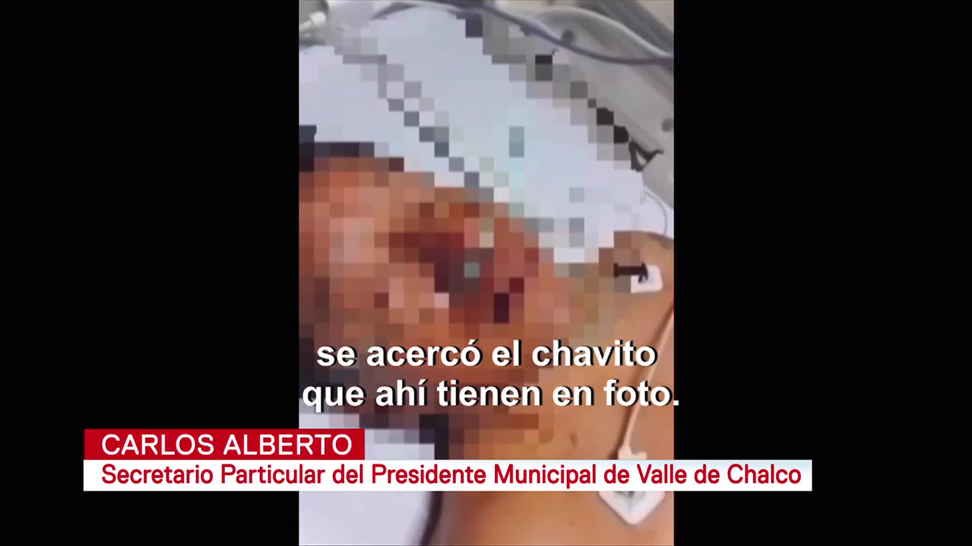 Foto: Secretario Alcalde Valle De Chalco Narra Ataque Cirugía 29 Octubre 2019