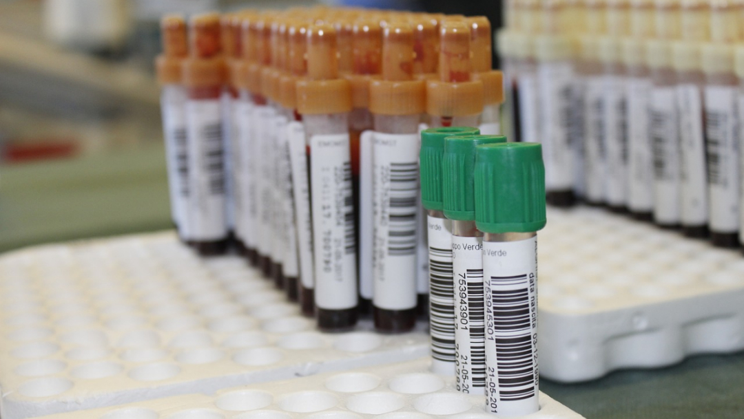 Nuevo análisis de sangre podría detectar hasta 20 tipos de cáncer