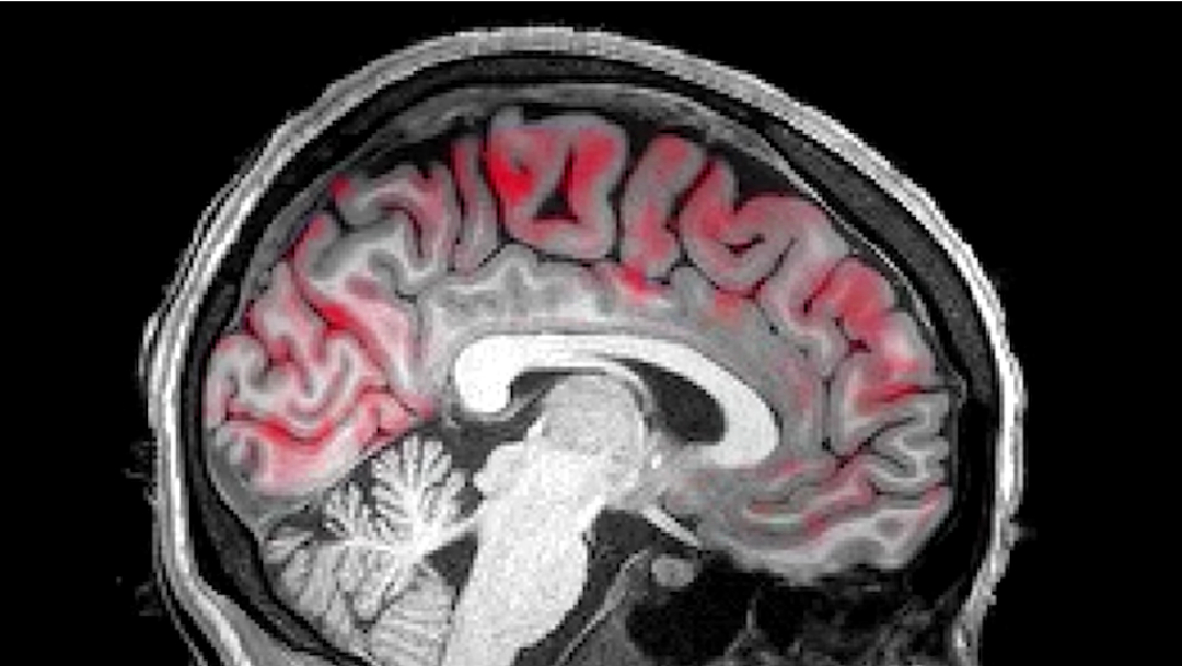 Cómo y para qué 'se lava' nuestro cerebro mientras dormimos