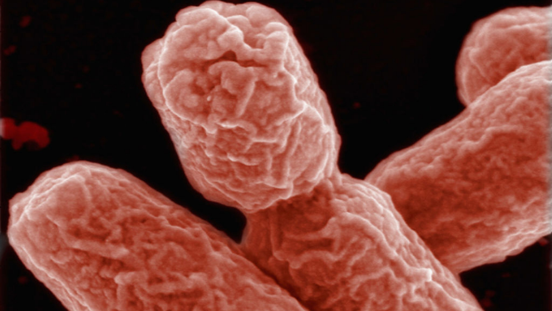 UNAM alerta que bacterias se están volviendo resistentes a los antibióticos