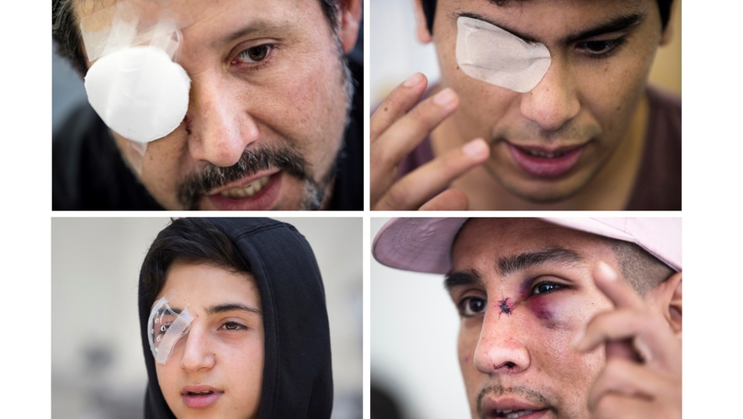 Foto: Protestas en Chile: Decenas de manifestantes han sufrido lesiones en ojos 
