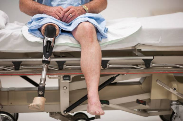 Imagen: En México, alrededor de 900 mil personas viven con amputaciones, de las cuales, sólo el 10 por ciento cuenta con una prótesis