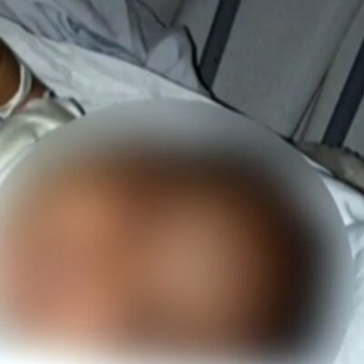 Bebé sufre quemaduras al estallar cohete de pirotecnia en Nuevo León