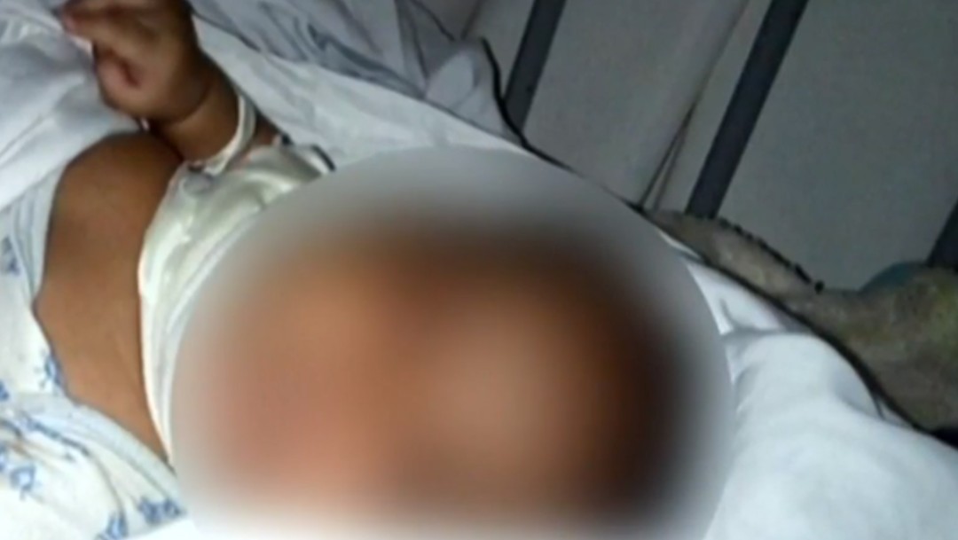 Foto: Bebé sufre quemaduras al estallar cohete de pirotecnia en Nuevo León