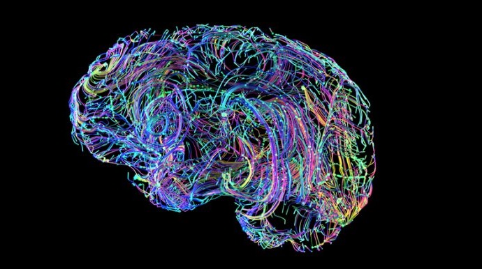 Foto: Este mapa 3D muestra la red neural del cerebro