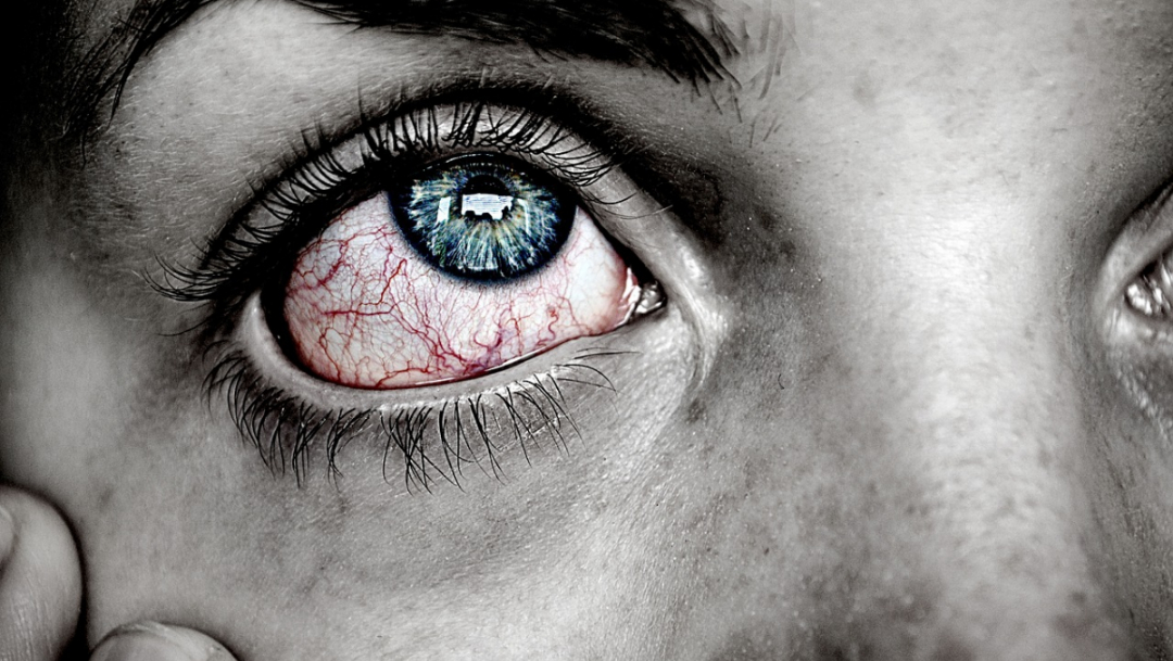 ¿Qué es la sífilis ocular y qué tan peligrosa es?