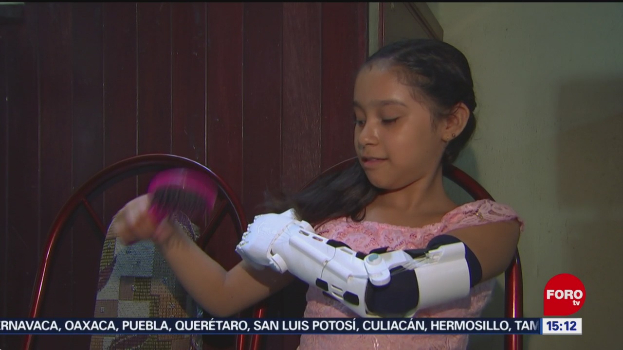 jovenes crean protesis mecanicas a bajo costo