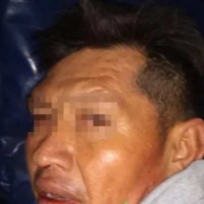 Hombre acuchilla a dos policías en Coyoacán, CDMX