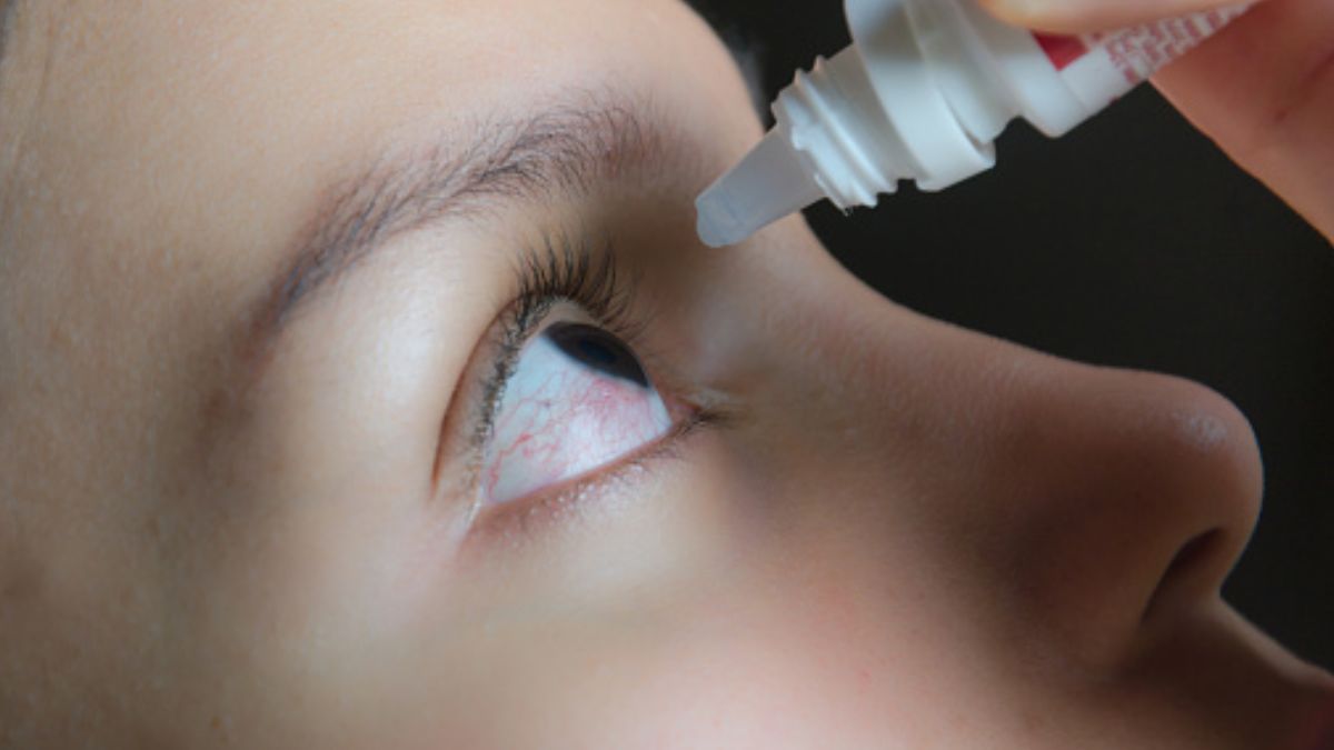 Foto: Un joven aplica gotas en los ojos. Getty Images