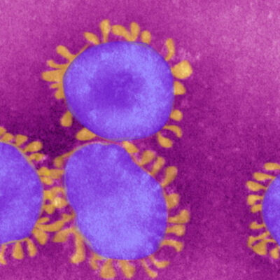 Vacuna contra coronavirus estaría lista en 10 años: experta