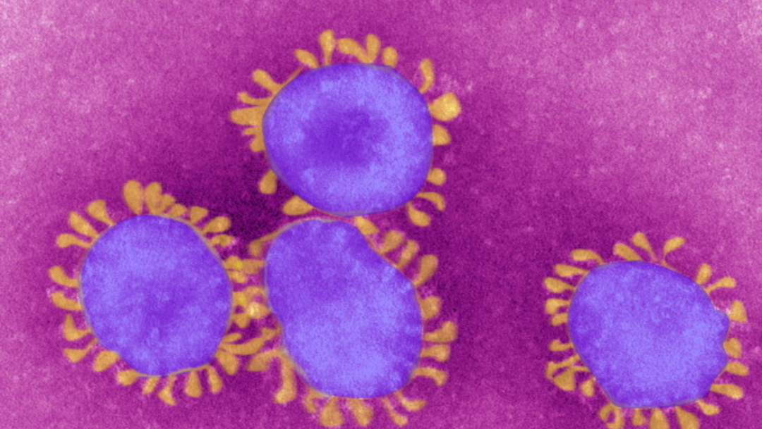Foto: Vacuna contra coronavirus estaría lista en 10 años: experta 09 de enero de 2020, (Getty Images)