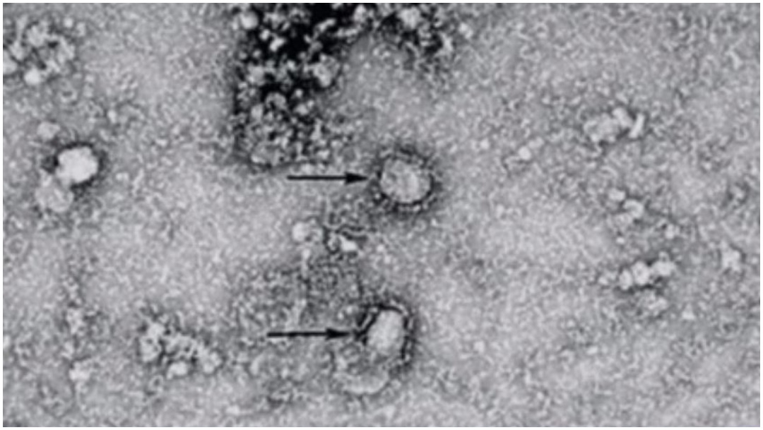 Foto: Coronavirus podría tener cura por experimentos australianos, el 29 de enero de 2020