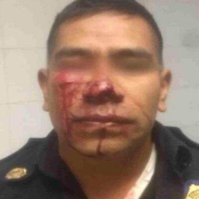 Muerde la nariz de policía tras prohibirle orinar en el Metro