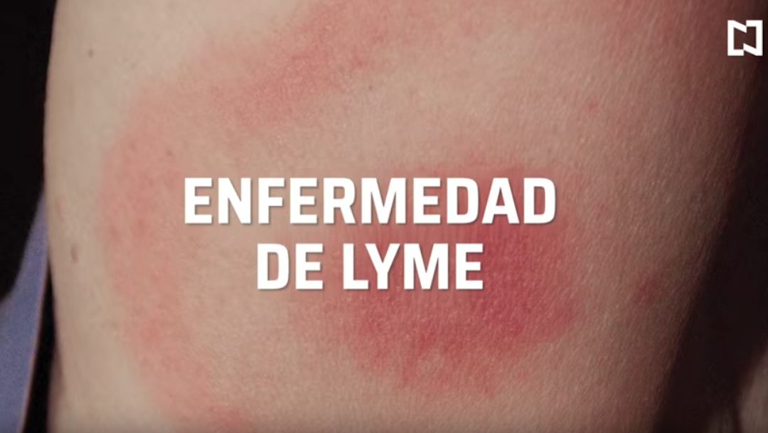 Foto Qué es y cuáles son los síntomas de la enfermedad de Lyme 16 enero 2020