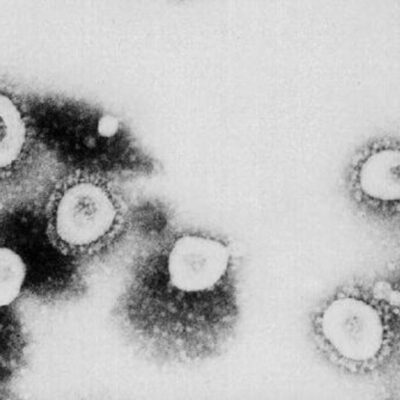 Científicos italianos aíslan el coronavirus para el desarrollo de tratamiento