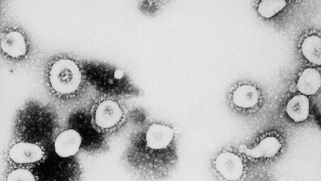 FOTO Coronavirus se propagará en Estados Unidos, admiten autoridades; piden prepararse (Getty Images)