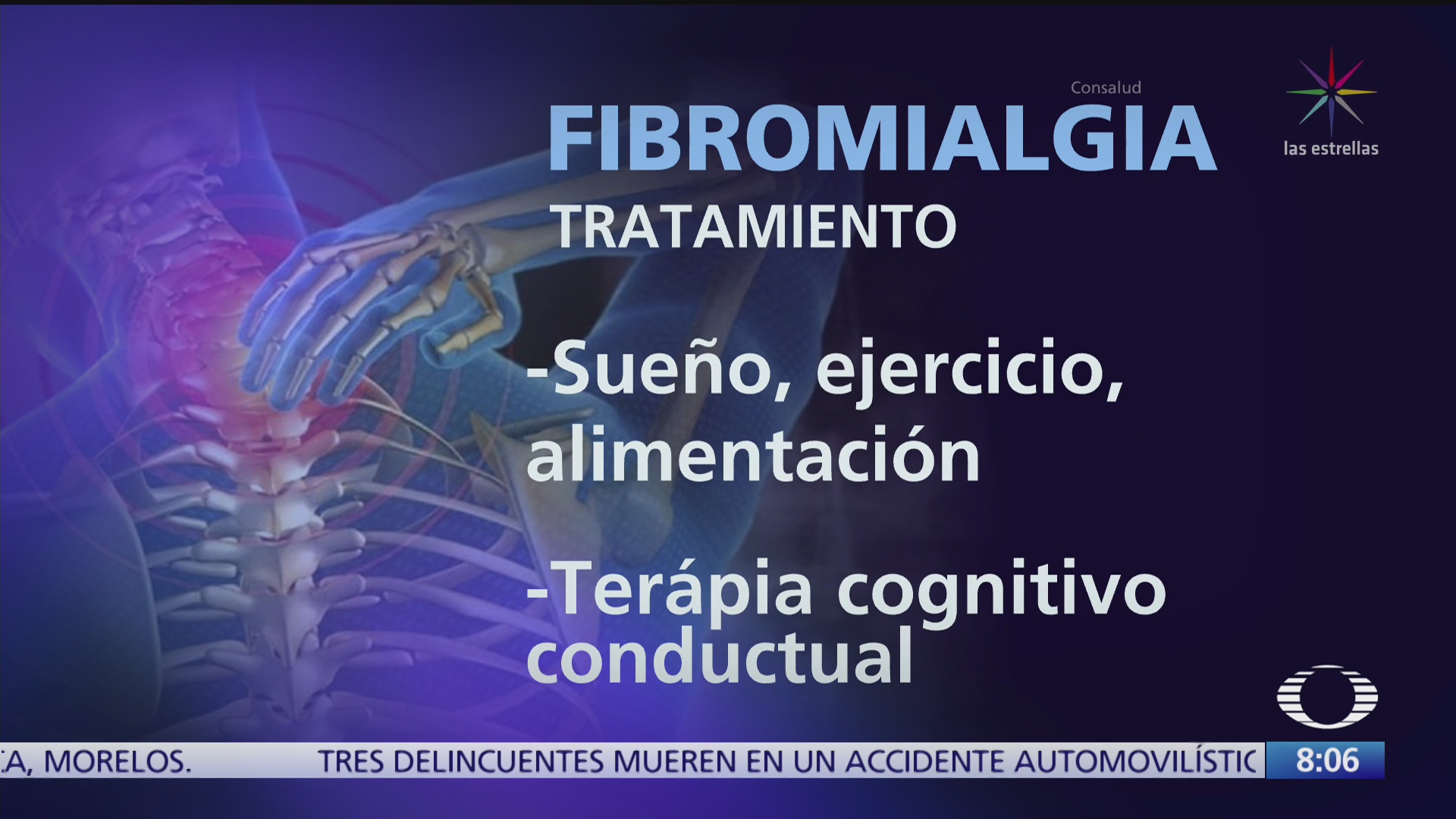 que es la fibromialgia y que detona la enfermedad