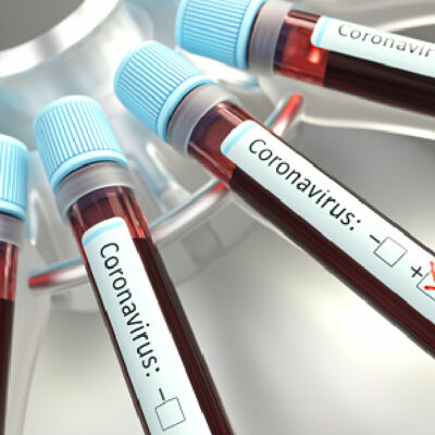 Campeche registra primer caso de coronavirus COVID-19 en la entidad