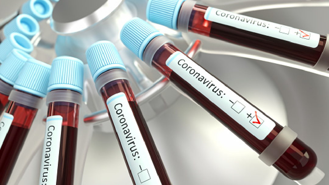 Foto: Científicos en el mundo trabajan para tener vacuna contra coronavirus cuanto antes, 19 de marzo de 2020, (Getty Images, archivo)