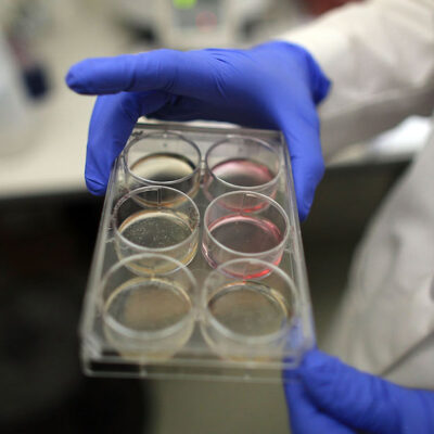 Laboratorio ofrece 96 mil pesos a voluntarios que se dejen infectar con coronavirus