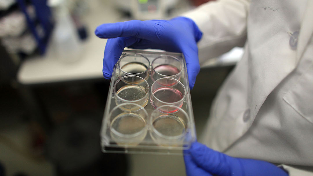 Foto Laboratorio ofrece 96 mil pesos a voluntarios que se dejen infectar con coronavirus 9 marzo 2020