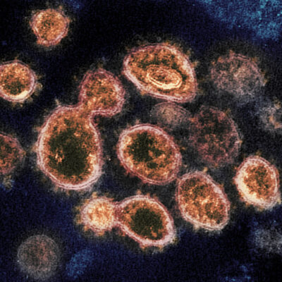 Mitos y mentiras sobre el Coronavirus
