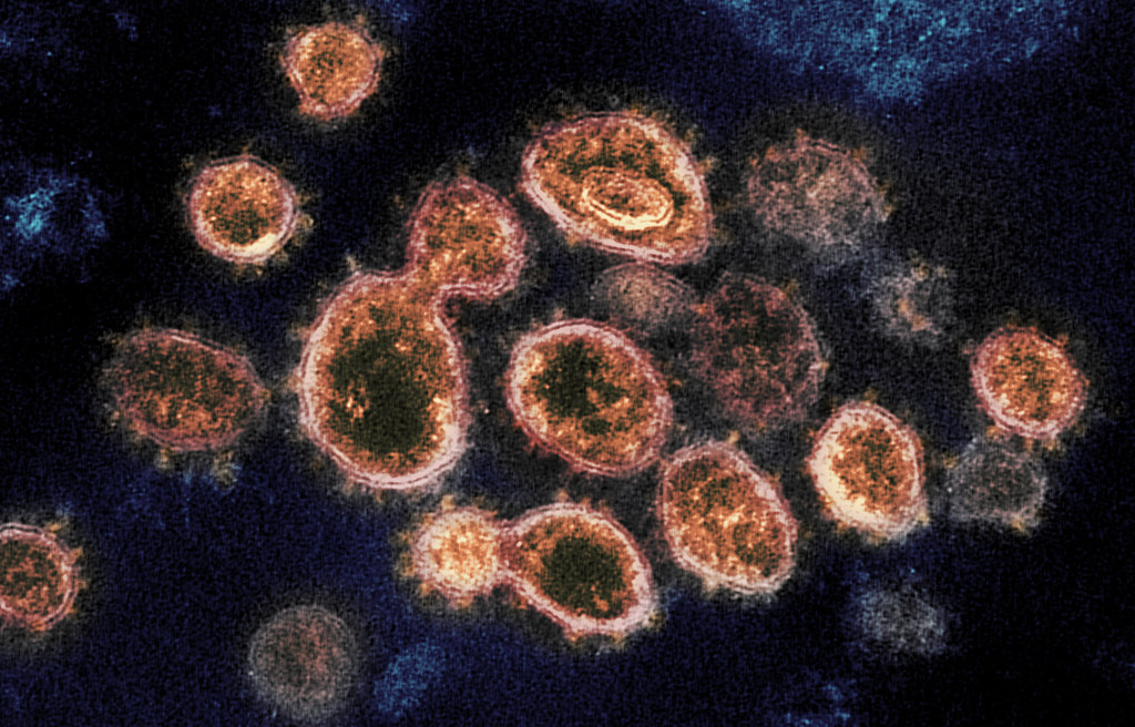 Mexico-Coronavirus-Mexico-Mitos-COVID-19-COVID-México-Organizacion-Mundial-Salud-OMS-Hoy, Ciudad de México, 23 de marzo 2020