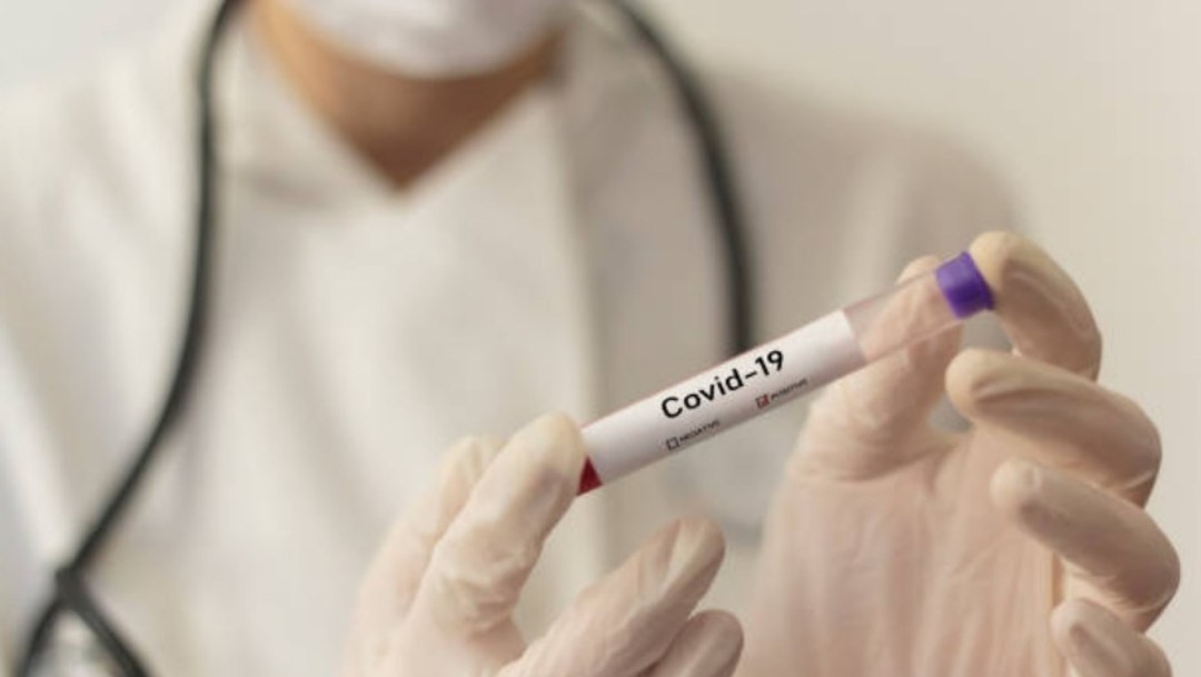 Muestra positiva de coronavirus COVID-19, 28 marzo 2020
