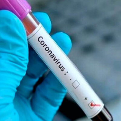 UNAM realizará diagnósticos de coronavirus a la comunidad universitaria a partir de este martes